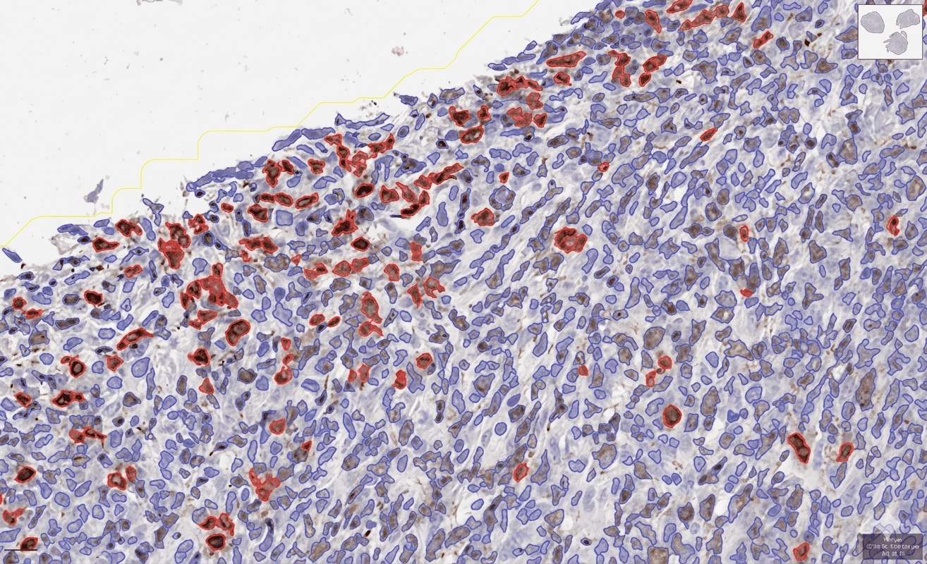 Uncover novel mechanisms