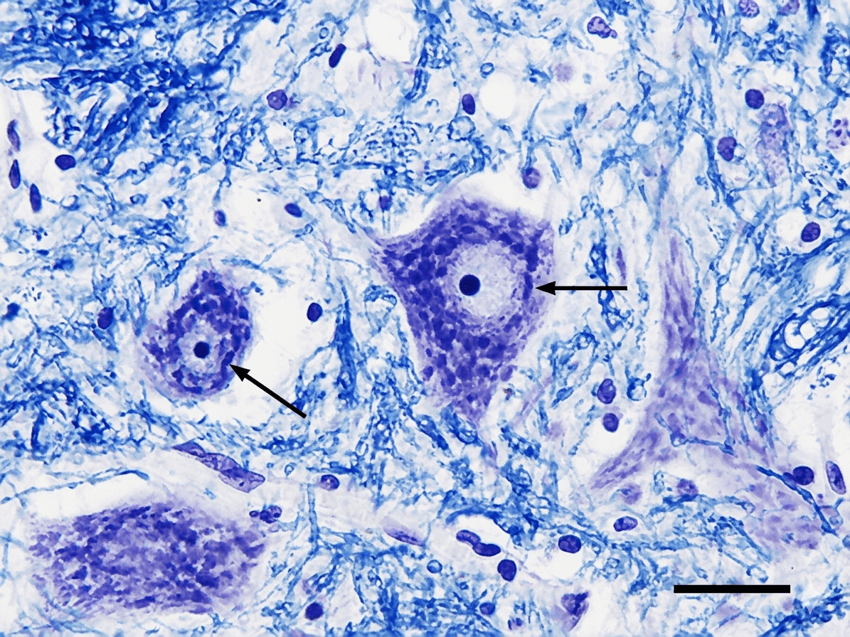 Accelerate target discovery